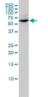 Western Blot: GLMN Antibody (1C12) [H00011146-M01]