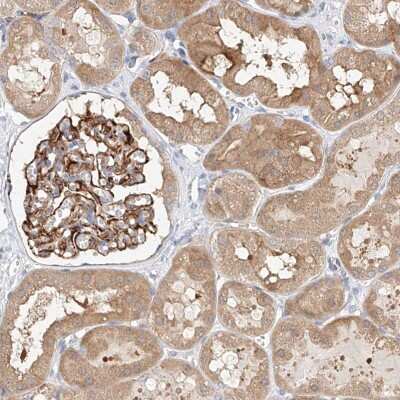 Immunohistochemistry-Paraffin: GLMN Antibody [NBP2-14056]