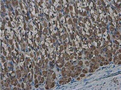 Immunohistochemistry-Paraffin: GLMN Antibody [NBP2-16669]