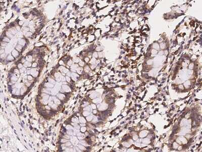 Immunohistochemistry-Paraffin: GLMN Antibody [NBP2-97214]