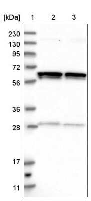 Western Blot: GLMN Antibody [NBP2-14054]