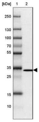 Western Blot: GLMN Antibody [NBP2-14056]