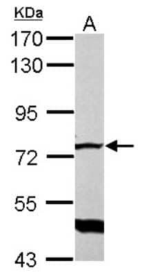 Western Blot: GLMN Antibody [NBP2-16669]