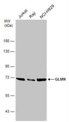 Western Blot: GLMN Antibody [NBP2-16669]