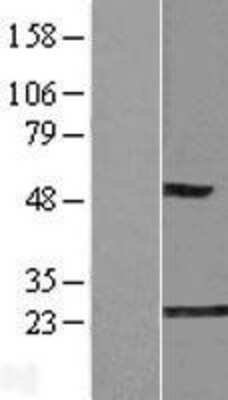 Western Blot: Glyoxalase I Overexpression Lysate [NBL1-11117]