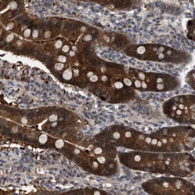 Immunohistochemistry-Paraffin: GLOD4 Antibody [NBP1-88462]