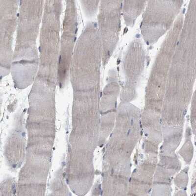 Immunohistochemistry-Paraffin: GLOD4 Antibody [NBP1-88462]