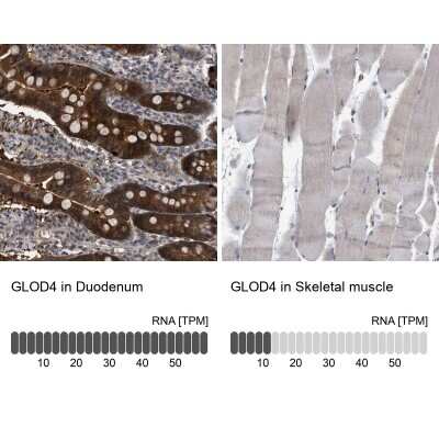 Immunohistochemistry-Paraffin: GLOD4 Antibody [NBP1-88462]