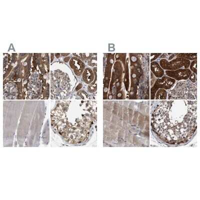 Immunohistochemistry-Paraffin: GLOD4 Antibody [NBP1-88462]