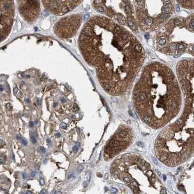 Immunohistochemistry-Paraffin: GLOD4 Antibody [NBP1-88462]