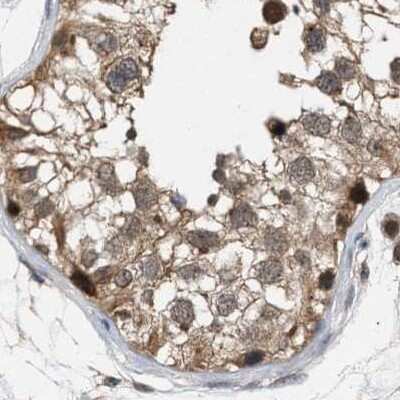 Immunohistochemistry-Paraffin: GLOD4 Antibody [NBP1-88462]