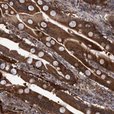 Immunohistochemistry-Paraffin: GLOD4 Antibody [NBP1-88463]