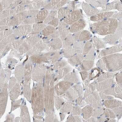 Immunohistochemistry-Paraffin: GLOD4 Antibody [NBP1-88463]