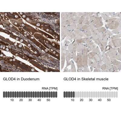 Immunohistochemistry-Paraffin: GLOD4 Antibody [NBP1-88463]