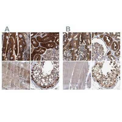 Immunohistochemistry-Paraffin: GLOD4 Antibody [NBP1-88463]