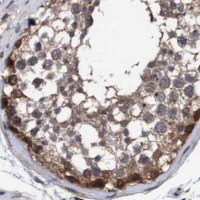 Immunohistochemistry-Paraffin: GLOD4 Antibody [NBP1-88463]