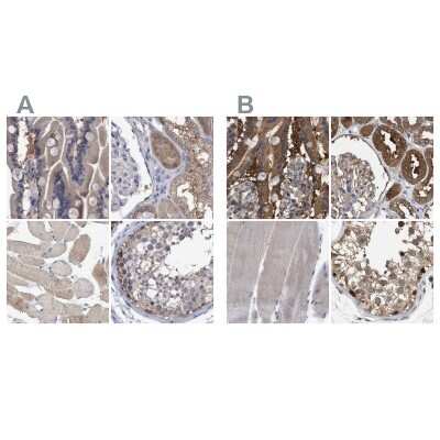 Immunohistochemistry-Paraffin: GLOD4 Antibody [NBP1-88464]