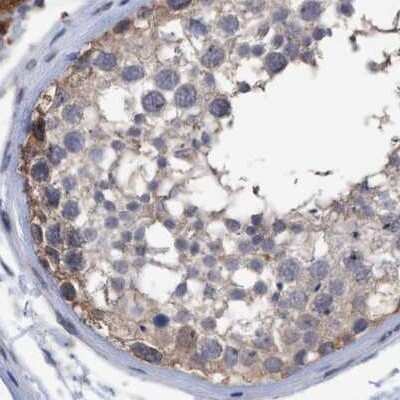 Immunohistochemistry-Paraffin: GLOD4 Antibody [NBP1-88464]