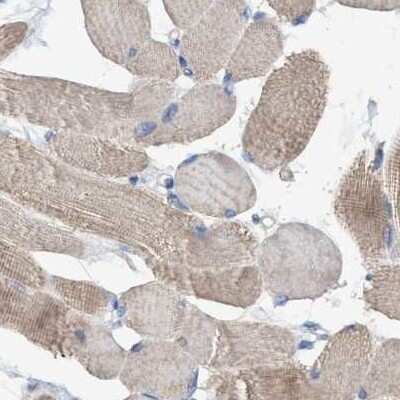Immunohistochemistry-Paraffin: GLOD4 Antibody [NBP1-88464]