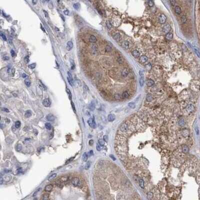 Immunohistochemistry-Paraffin: GLOD4 Antibody [NBP1-88464]