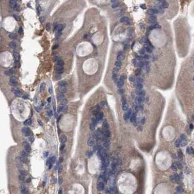 Immunohistochemistry-Paraffin: GLOD4 Antibody [NBP1-88464]