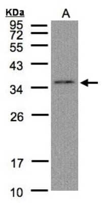 Western Blot: GLOD4 Antibody [NBP1-32282]