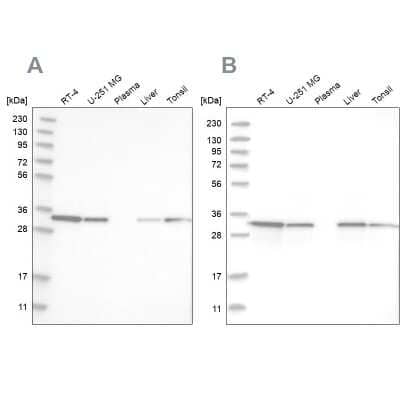 Western Blot: GLOD4 Antibody [NBP1-88462]