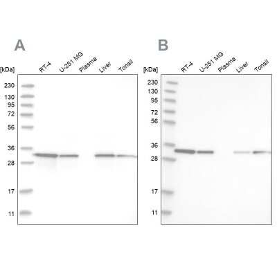 Western Blot: GLOD4 Antibody [NBP1-88463]