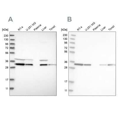 Western Blot: GLOD4 Antibody [NBP1-88464]