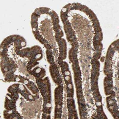 Immunohistochemistry-Paraffin: GLOD5 Antibody [NBP1-91105]