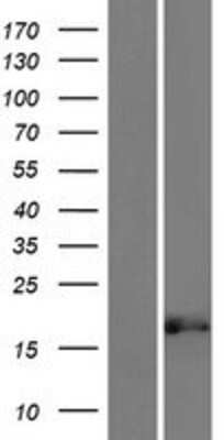 Western Blot: GLOD5 Overexpression Lysate [NBP2-10223]