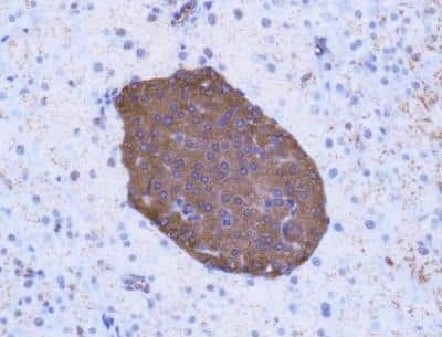 Immunohistochemistry: GLP-1R Antibody - BSA Free [NBP1-97308]