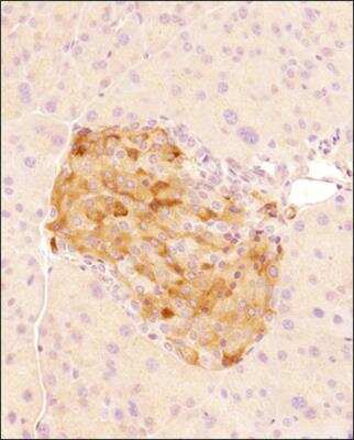 Immunohistochemistry-Paraffin: GLP-1R Antibody - BSA Free [NBP1-97308]