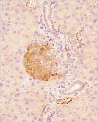 Immunohistochemistry-Paraffin: GLP-1R Antibody - BSA Free [NBP1-97308]