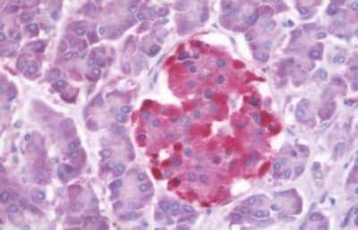 Immunohistochemistry-Paraffin: GLP-1R Antibody [NBP3-14335]