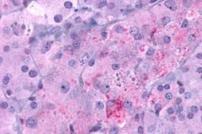 Immunohistochemistry-Paraffin: GLP-1R Antibody [NBP3-14335]