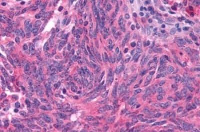 Immunohistochemistry-Paraffin: GLP-1R Antibody [NBP3-14335]