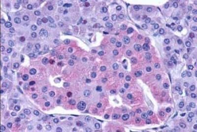 Immunohistochemistry-Paraffin: GLP-1R Antibody [NBP3-14335]