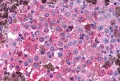 Immunohistochemistry-Paraffin: GLP-1R Antibody [NBP3-14335]