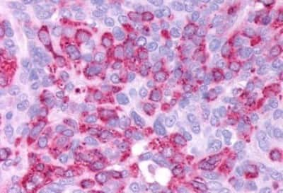 Immunohistochemistry-Paraffin: GLP-1R Antibody [NBP3-14335]