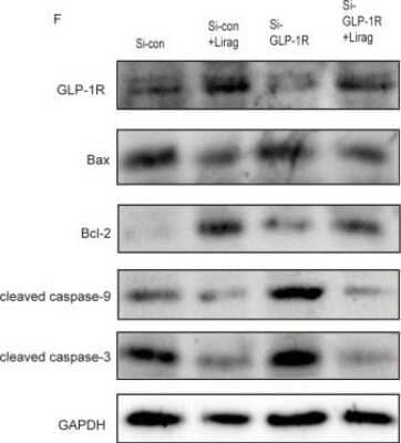 Knockdown Validated: GLP-1R Antibody - BSA Free [NBP1-97308]