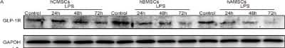 Western Blot: GLP-1R AntibodyBSA Free [NBP1-97308]