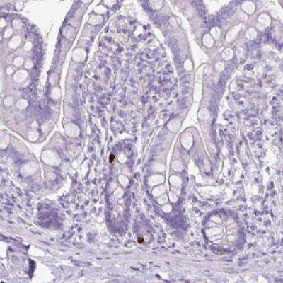 Immunohistochemistry-Paraffin: GLP-2R Antibody [NBP2-33557]