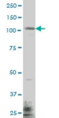 Western Blot: GLP/EHMT1 Antibody (1H2) [H00079813-M04]