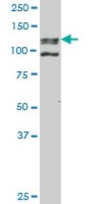 Western Blot: GLP/EHMT1 Antibody (3G1) [H00079813-M05]