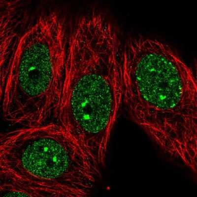 Immunocytochemistry/ Immunofluorescence: GLP/EHMT1 Antibody [NBP2-57166]