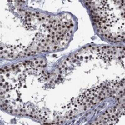 Immunohistochemistry-Paraffin: GLP/EHMT1 Antibody [NBP3-17670]