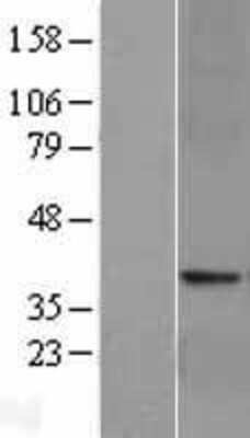 Western Blot: GLP-1R Overexpression Lysate [NBP2-04215]