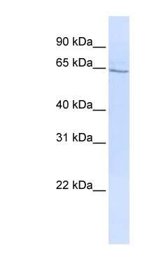 Western Blot: GLP-2R Antibody [NBP1-59029]