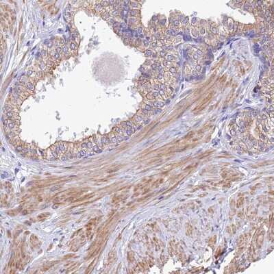 Immunohistochemistry-Paraffin: GLRA4 Antibody [NBP1-91207]